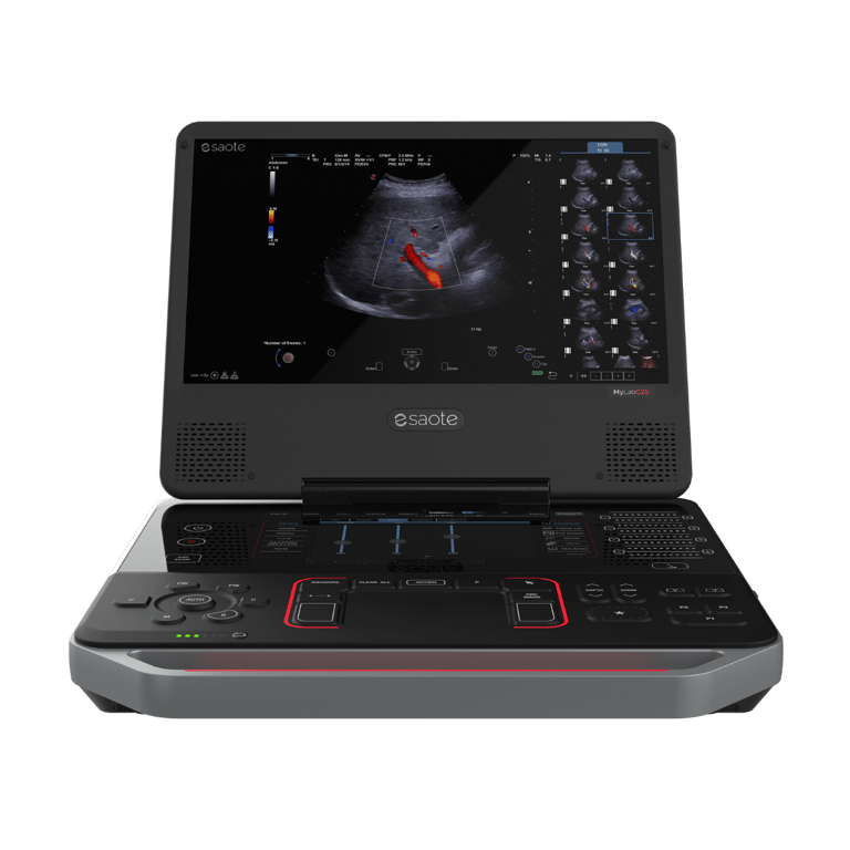 Esaote MyLab C25 kompaktes Ultraschallsystem