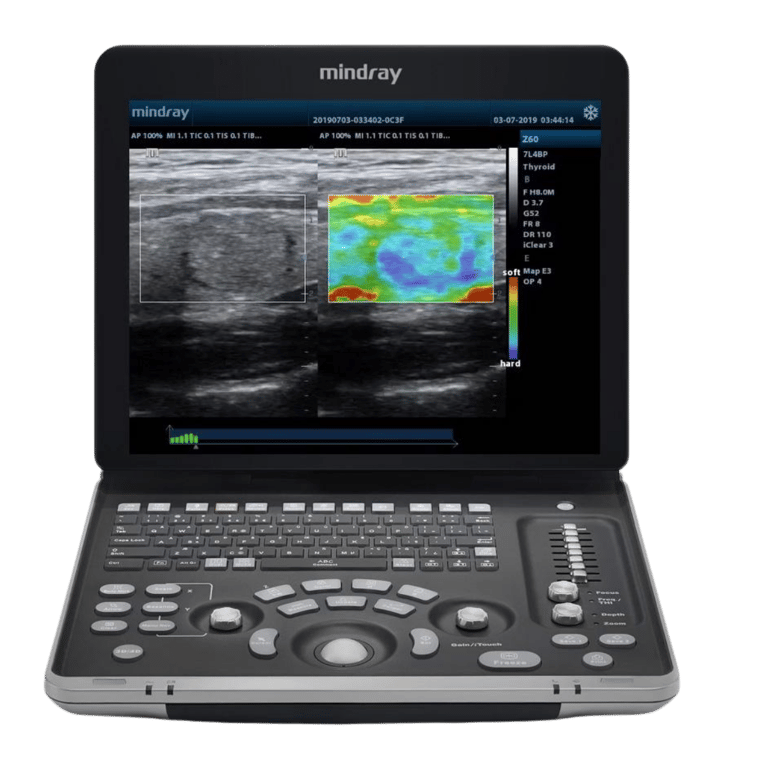 Mindray DP-50