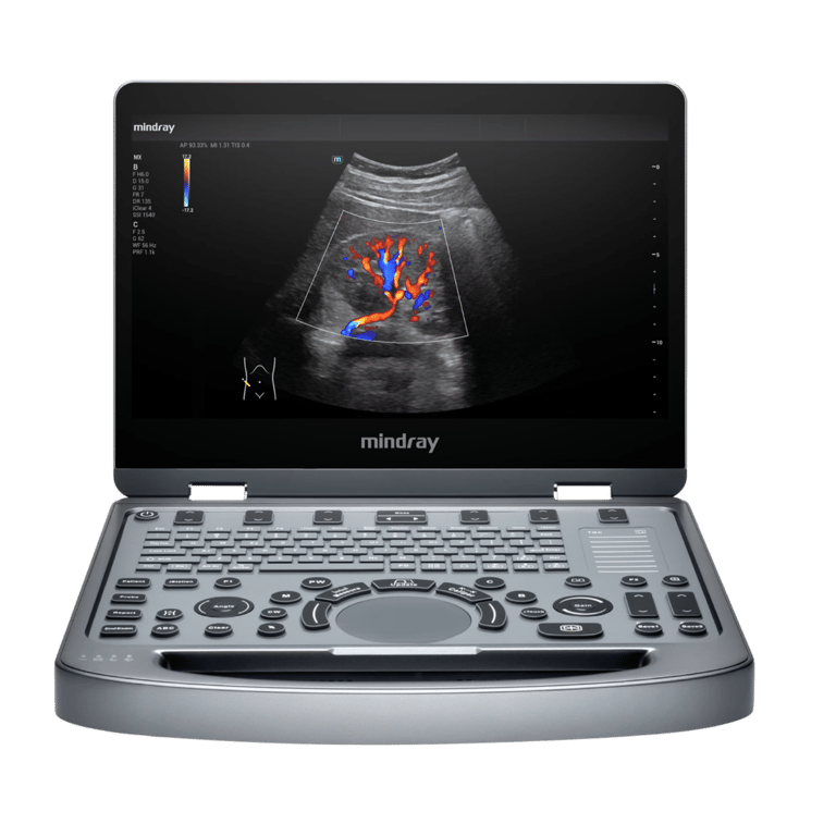 Mindray MX3 Kompakt-Ultraschallsystem Einstiegsmodell Magic X Serie